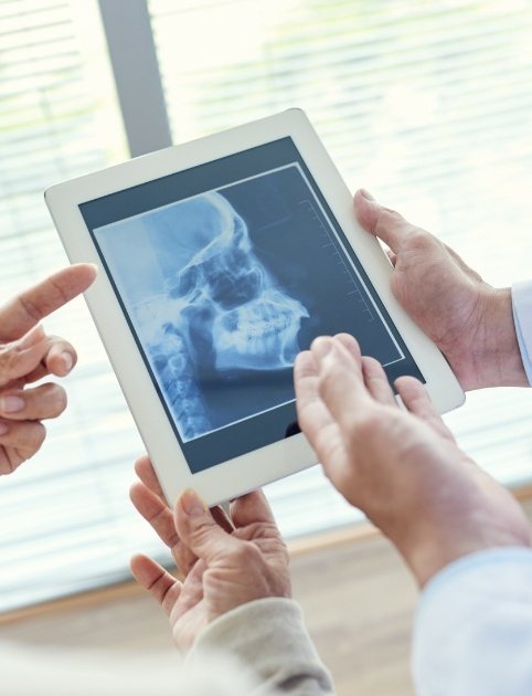 Dentist and team member looking at x-rays before providing neuromuscular dentistry