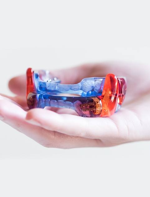 Sleep apnea oral appliance in the palm of a hand