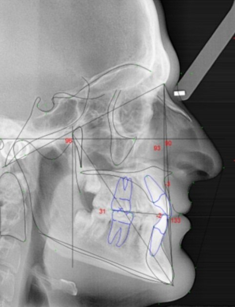 Craniofacial musculature analysis images on computer screen