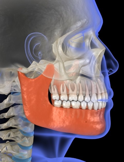 3 D animated jaw and skull showing the cause of T M J dysfunction