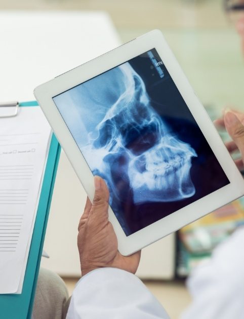 Dentist and team member looking at x-ray during neuromuscular dentistry treatment