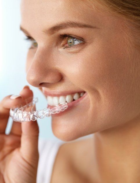 Woman placing orthodontic collection aligner device