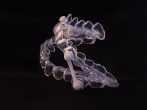 Results of cleaning oral appliance in Topeka. 